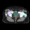 plateforme d'IA médicaleVarian Oncology
