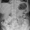 logiciel de visualisationUNIQUE 2Philips Healthcare
