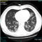 logiciel de diagnostic du Covid-19COVID-19 AI Diagnostic AssistantNovarad