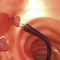 panier endoscopique pour extraction de polypes intestinauxSensor®G-FLEX Europe