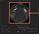 logiciel médical / TDM / d'analyse d'image