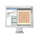 logiciel de marquage laser / médical / médicale / de reporting