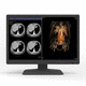 écran de diagnostic / pour radiologie / 30