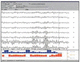 logiciel pour EMG / pour cabinet vétérinaire / d'analyse