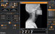 logiciel pour imagerie anatomique / pour imagerie orthopédique / de radiographie / de diagnostic