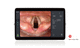 processeur vidéo d'endoscopie / avec moniteur vidéo / imagerie Full HD