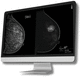 logiciel médical pour tomosynthèse mammaire / d'analyse / d'interprétation / pour dépistage du cancer du sein