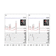 logiciel d'analyse / IRM