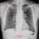 logiciel intelligence artificielle / de visualisation / de diagnostic / TDM