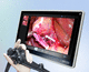enregistreur vidéo avec conversion fichiers DICOM / de diagnostic / avec écran tactile / 4K
