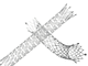 stent veineux