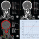 module logiciel médical / pour imagerie cérébrale / de diagnostic / avec système de suivi