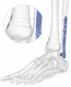 plaque de compression de tibia / de fibula / de cheville / distale