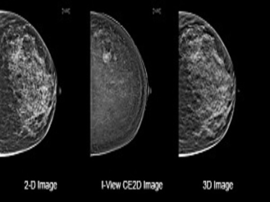 Avenir du 3D de la mammographie