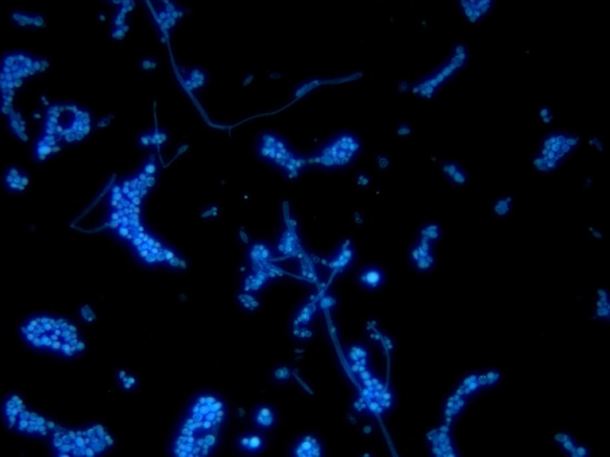 Fungis sous le microscope de fluorescence