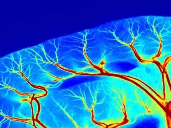 Introduction détaillée du système d'imagerie à contraste de chatoiement laser RFLSI ZW