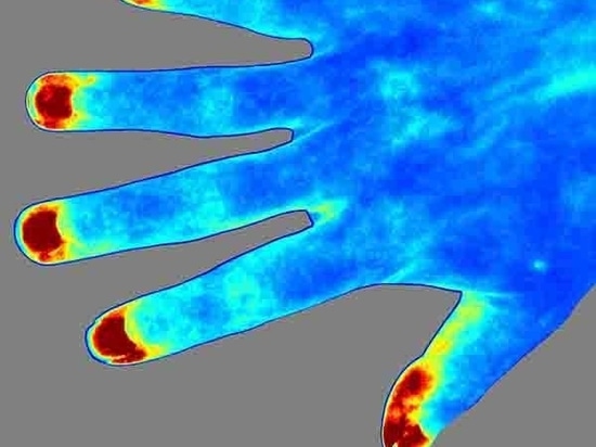 Introduction détaillée du système d'imagerie à contraste de chatoiement laser RFLSI ZW