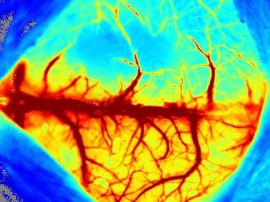 Introduction détaillée du système d'imagerie à contraste de chatoiement laser RFLSI ZW