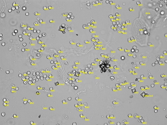 Résultats de l'Urilyzer® Cell