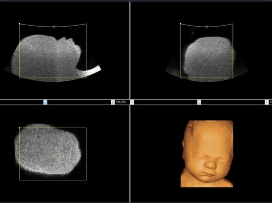 Machine à ultrasons Dawei Medical 3D à vendre