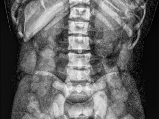 Formation à la radiographie du corps entier pour adultes Phantom X-Ray