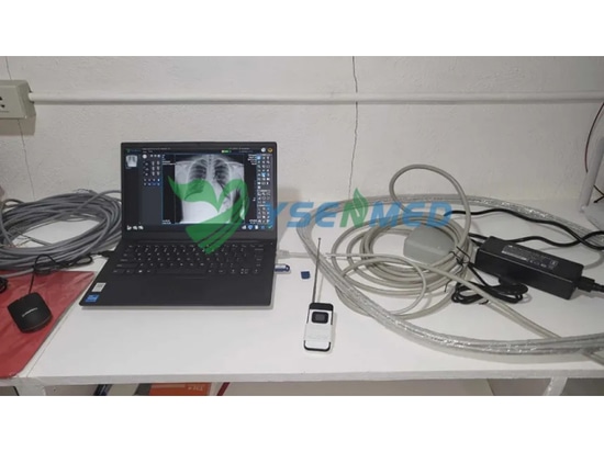 Les médecins philippins sont satisfaits de l'appareil de radiographie numérique portable YSENMED YSX056-PE.