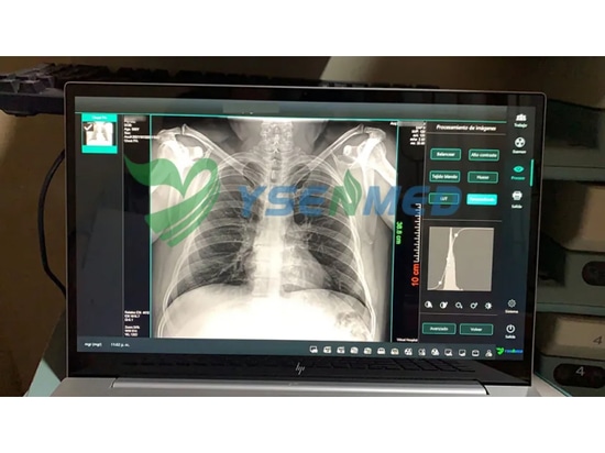 Client bolivien satisfait du détecteur à écran plat YSENMED YSFPD4343A.
