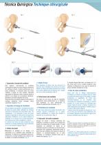 COTYLES DE TYPE MÜLLER - 5