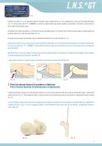 TECHNIQUE CHIRURGICALE LNS GT - 9