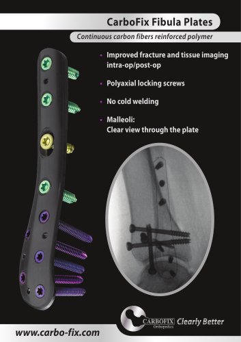 CarboFix Fibula Plates