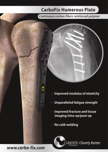 CarboFix Humerous Plate