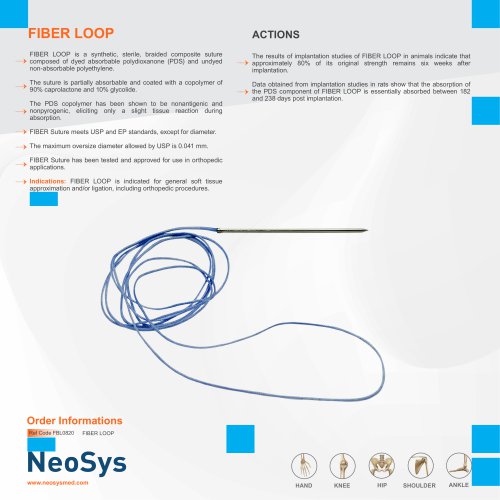 fiber loop