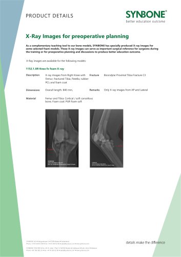 X-Ray Images for preoperative planning