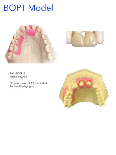 BOPT Model