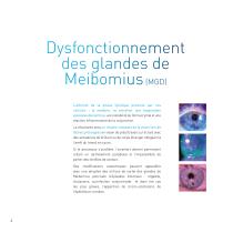 Traitement technologique du syndrome de l'oeil sec MGD - 4