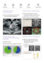 Olea Sphere - Body Brochure - FR - 2