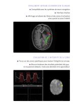 Olea Sphere - fMRI Brochure - FR - 2