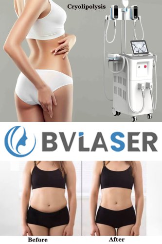 best professional cryolipolysis machine cryolipolysis fat freeze slimming machine FDA approved