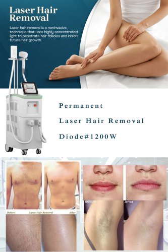 China big spot size diode laser hair removal machine-BVLASER. High power diode laser hair removal CE certification. Professional laser hair removal machine manufacturer.