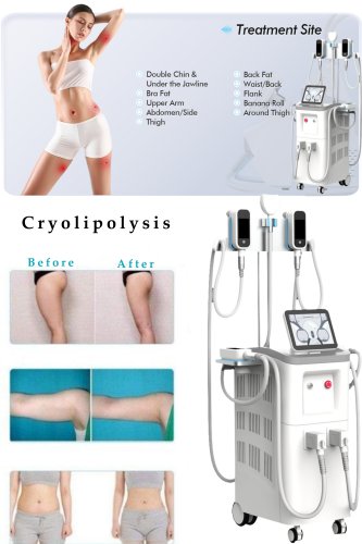 China cryolipolysis machine manufacturer-BVLASER. Cryolipolysis fat freeze slimming machine FDA approved.