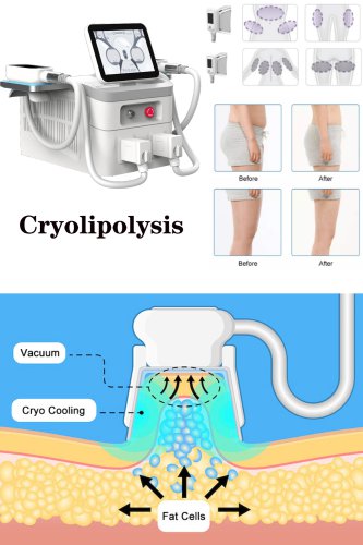 cryolipolysis fat freezing slimming machine professional cryo body slimming beauty machine