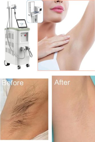 medical grade laser hair removal machine professional