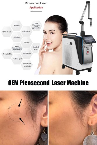 OEM picosecond laser machine. CE certification picosecond laser tattoo removal machine. China picosecond laser in laser beauty equipment-BVLASER.