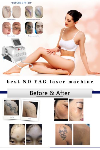 Wholesale ND YAG laser tattoo removal machine. ND YAG laser dermatology. China Q-switched ND YAG laser machine manufacturer-BVLASER.