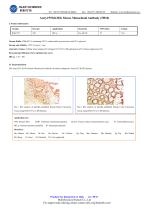 Acetyl P53(K382) Mouse Monoclonal Antibody (5H10)