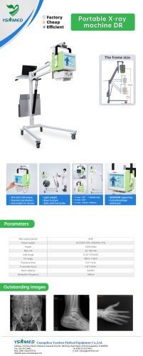 Fatali 5.0KW Portable X-ray Machine YSDR-050