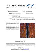 ACTH (Adrenocorticotropic Hormone)