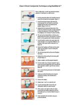 Class II Direct Composite Technique using ReelMatrix™