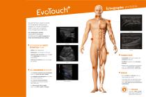 EvoTouch+ : Échographe portable Imagerie Interventionnelle - 2