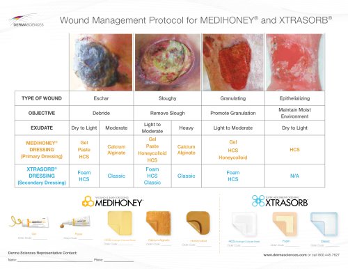 MediHoney® Poster - Aballay Partial Thickness Facial Burns